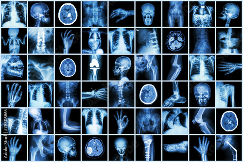Fotografie, Obraz X-ray multiple part of adult and child and Disease