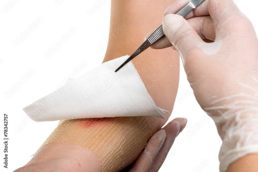 Medical assistant changes the dressing of a wound at the - obrazy, fototapety, plakaty 