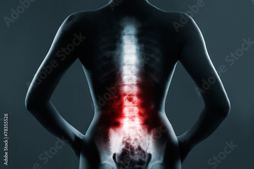 Fotografía The lumbar spine is highlighted by red colour