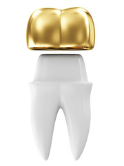 Golden Dental Crown on a Tooth isolated on white background