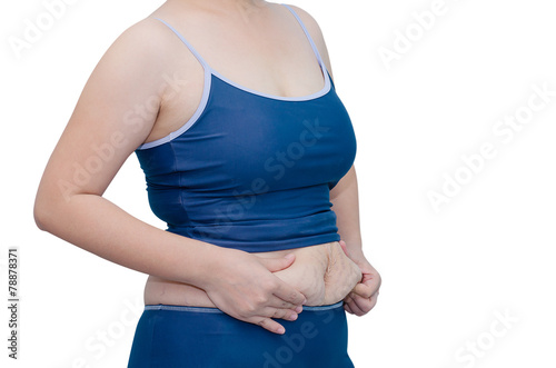Fotografia, Obraz Asian woman in swim suit showing her stretch marks
