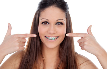 Wall Mural - Attractive young woman pointing her brackets