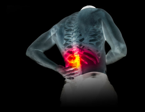 Human skeleton under the x-rays isolated on black background