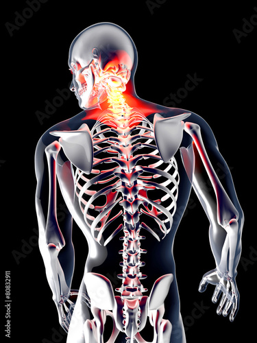Naklejka na kafelki Anatomy - Back Pain.