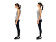Woman with impaired posture position defect scoliosis and ideal