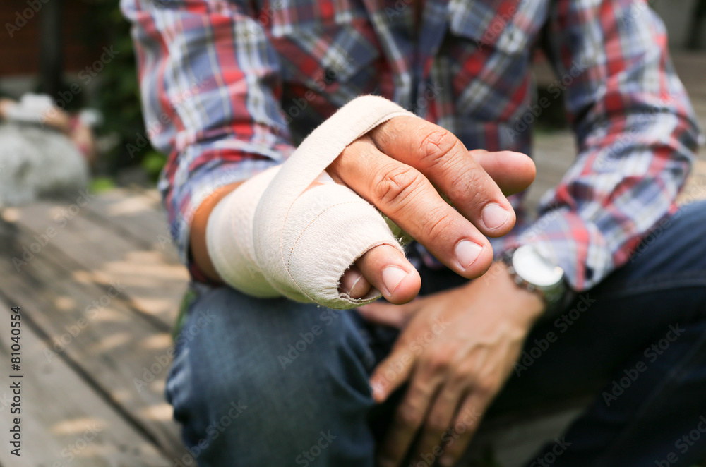 Splint broken bone  hand Injured - obrazy, fototapety, plakaty 