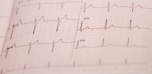 Electrocardiogram Close-up