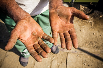 Injured open palms