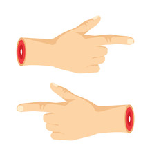 Two Severed Pointing Hands With Pointing Fingers