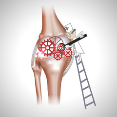 Wall Mural - Knee joint abstract treatment