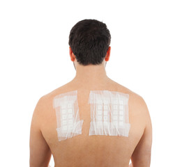 skin allergy patch test on back