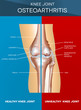 Osteoarthritis and normal joint