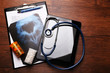 © Africa Studio - Stethoscope, pills, clipboard and tablet on wooden background