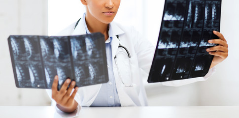 Poster - african doctor looking at x-rays