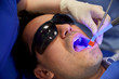 close up of male patient with dental curing light