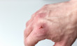 horizontal image of a close up shot of a caucasian hand with a cut on the knuckle isolated on white background. 