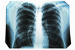© Africa Studio - X-ray of human chest, closeup