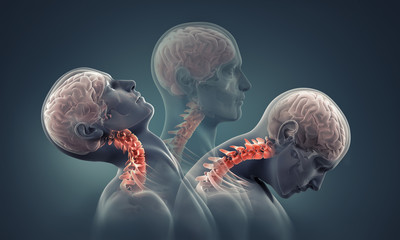 man x-ray with neck bones highlighted