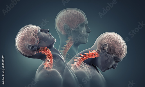 Cuadros en Lienzo man x-ray with neck bones highlighted