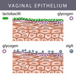 Vaginal Epithelium with Glycogen