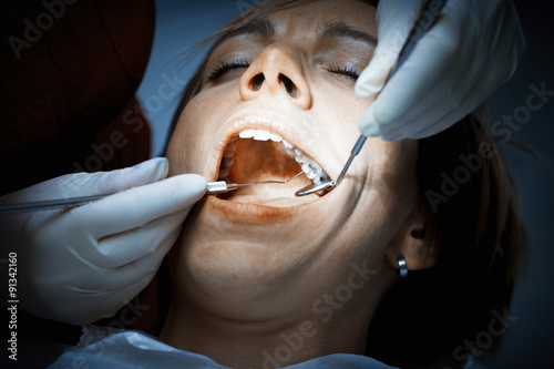 Fotografia, Obraz Dentist examining a patients teeth at the dental clinic.