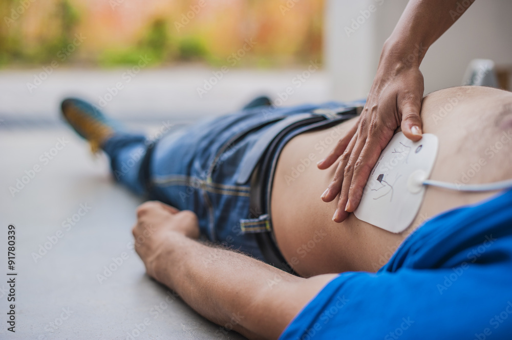 Applicazione elettrodi defibrillatore - obrazy, fototapety, plakaty 