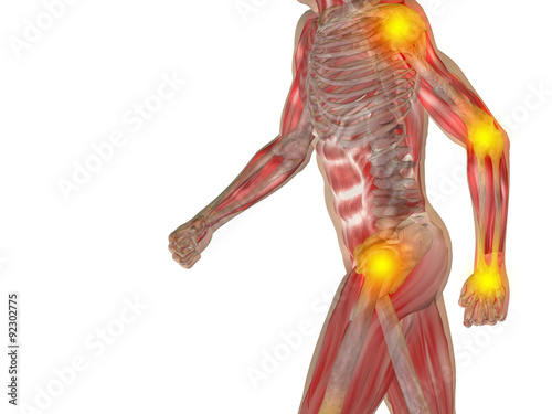 Obraz w ramie Conceptual human pain anatomy