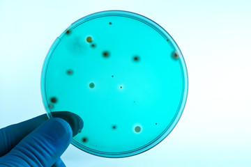 Wall Mural - hand of a technician holding green petri dish in laboratory /doctor with a petrie dish in the microbiology lab