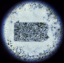 Bacterias in the shape of Pennsylvania viewed through a microsco