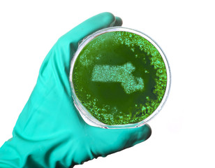 germs in the shape of massachusetts in a petri dish.(series)