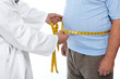 Doctor measuring obese man stomach.