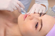 © Микола Ковальчинськи - Beautiful woman gets an injection in her lips.