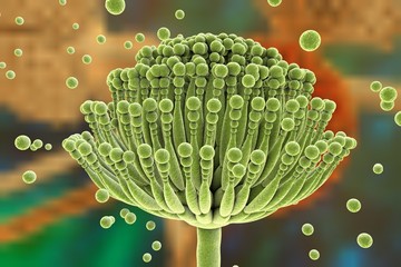 Canvas Print - Fungi Aspergillus, Aspergillus fumigatus, Aspergillus niger on colorful background, black mold, which produce aflatoxins, cause pulmonary infection aspergillosis