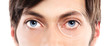 Closeup of blue eyes from a young man red and irritated eye with