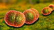 Meningitis Bacteria Infection