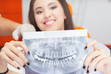 Patient beautiful girl holding x-ray picture of her teeth