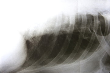 Film x-ray