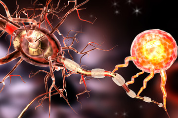 3d illustration of nerve cells, concept for Neurological Diseases, tumors and brain surgery.