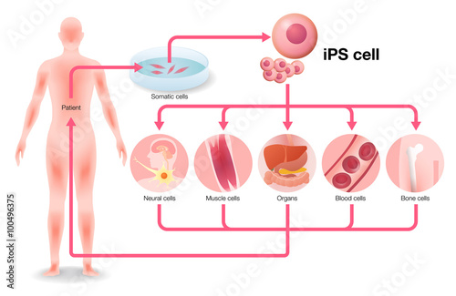 Fotografie, Obraz induced pluripotent stem cell (iPS cell) and regenerative medicine, vector illus