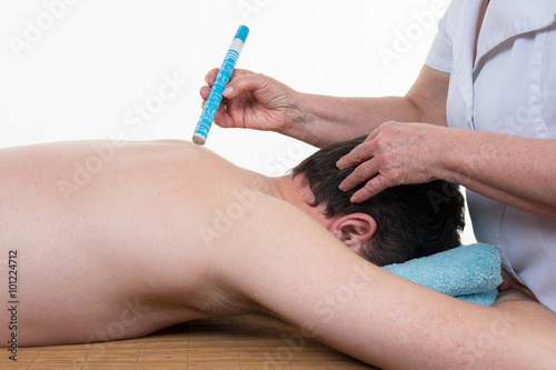 Cuadros en Lienzo An alternative eastern Moxa treatment on a man back