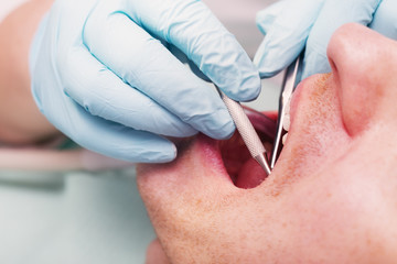 Dentist examine patient's teeth