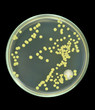 Colonies of bacteria from sea water on a petri dish (agar plate) isolated on black background. Nutrient agar media (meat-peptone agar) used.  Focus on full depth.