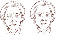 White Background Vector Illustration Of A  Facial Lopsided Illus