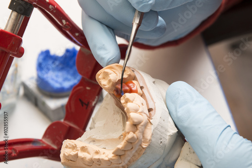 Fotografia, Obraz hands of dentist working on a dental implant