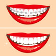 Illustration of two happy smiles showing before and after whitening teeth process