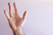 © perfectmatch - Hand of an man with Dupuytren contracture  disease, against  bright background, isolated