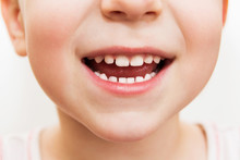 Baby Smile Close. Child Teeth On A White Isolated Background.