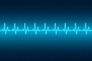 Heart cardiogram monitor. Rhythm heart.