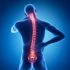 Sticker - Spine injury pain in sacral and cervical region concept