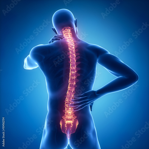 Fotografía Spine injury pain in sacral and cervical region concept